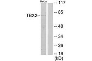 Image no. 1 for anti-T-Box 2 (TBX2) (AA 251-300) antibody (ABIN1533859)