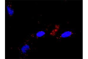 Image no. 1 for anti-Ral Guanine Nucleotide Dissociation Stimulator (RALGDS) (AA 1-902) antibody (ABIN519629)