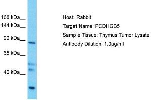 Image no. 1 for anti-Protocadherin gamma Subfamily B, 5 (PCDHGB5) (Middle Region) antibody (ABIN2783726)