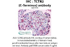 Image no. 1 for anti-Tectonic Family Member 2 (TCTN2) (C-Term) antibody (ABIN1739965)
