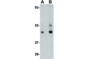 Image no. 1 for anti-Platelet-Activating Factor Acetylhydrolase 1b, Regulatory Subunit 1 (45kDa) (PAFAH1B1) (C-Term) antibody (ABIN6657115)