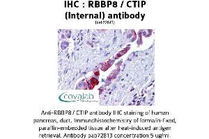 Image no. 3 for anti-Retinoblastoma Binding Protein 8 (RBBP8) (Internal Region) antibody (ABIN1738768)