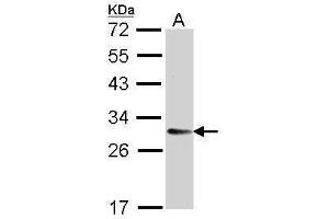 Image no. 3 for anti-Transmembrane Emp24 Protein Transport Domain Containing 9 (TMED9) (Center) antibody (ABIN2855305)