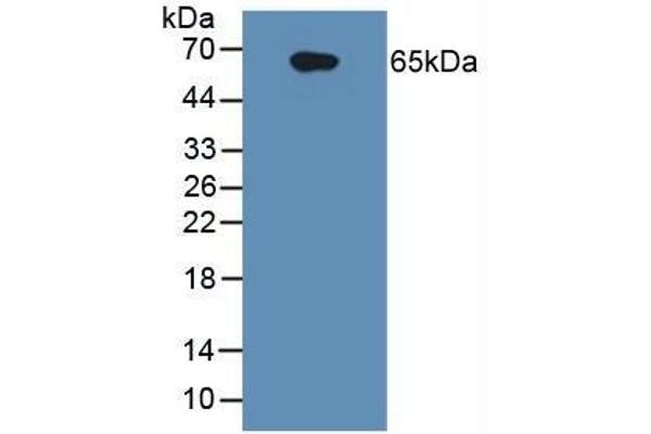 IL1R1 antibody  (AA 21-109)