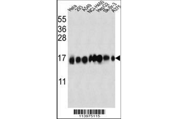 anti-Interferon-Induced Transmembrane Protein 3 (IFITM3) (AA 1-30), (N-Term) antibody