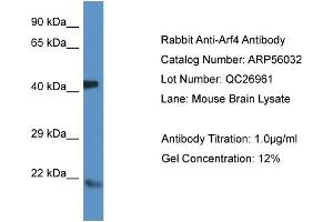 Image no. 1 for anti-ADP-Ribosylation Factor 4 (ARF4) (N-Term) antibody (ABIN2786490)