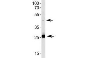 Image no. 4 for anti-Sirtuin 3 (SIRT3) (AA 250-279) antibody (ABIN3032590)