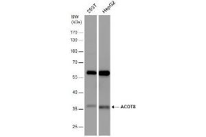 WB Image ACOT8 antibody detects ACOT8 protein by western blot analysis.