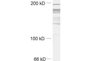 Image no. 1 for anti-Regulating Synaptic Membrane Exocytosis 2 (RIMS2) (AA 925-1114) antibody (ABIN1742309)
