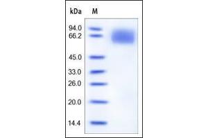 Human IL-6 R alpha, His Tag on SDS-PAGE under reducing (R) condition.