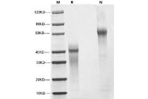 IL12 Protein (AA 23-219, AA 23-328)