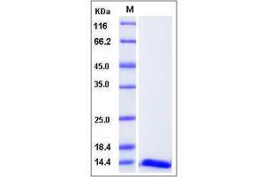 Image no. 1 for Fatty Acid Binding Protein 6, Ileal (FABP6) (AA 1-128) protein (ABIN2005271)
