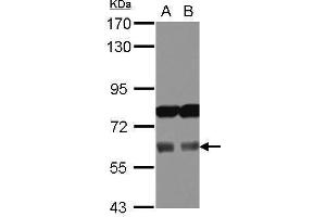 Image no. 1 for anti-Achalasia, Adrenocortical Insufficiency, Alacrimia (AAAS) (Internal Region) antibody (ABIN2854764)
