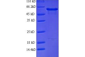 Image no. 1 for DEAD (Asp-Glu-Ala-Asp) Box Polypeptide 58 (DDX58) (AA 1-430), (ATP-binding domain) protein (His tag) (ABIN5709395)