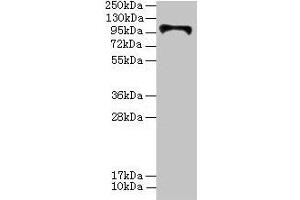 Western blot All lanes: HKDC1 antibody at 4 μg/mL + U87 whole cell lysate Secondary Goat polyclonal to rabbit IgG at 1/10000 dilution Predicted band size: 103, 91, 83 kDa Observed band size: 103 kDa