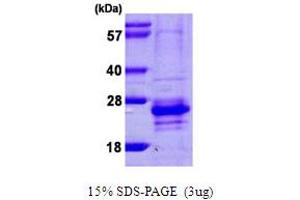 Image no. 1 for Calcium Binding Protein 7 (CABP7) (AA 1-188) protein (His tag) (ABIN6386743)