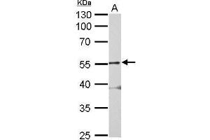 Image no. 2 for anti-Glycine Receptor, alpha 2 (GLRa2) (Center) antibody (ABIN2856145)