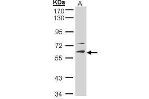 WB Image Sample(30 ug whole cell lysate) A:Hep G2 , 10% SDS PAGE antibody diluted at 1:2000