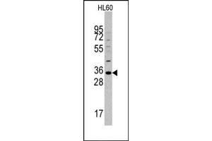 Image no. 1 for anti-Monoacylglycerol O-Acyltransferase 2 (MOGAT2) (C-Term) antibody (ABIN356673)