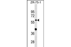 GDPD2 Antibody (Center) (ABIN1538279 and ABIN2849892) western blot analysis in ZR-75-1 cell line lysates (35 μg/lane).