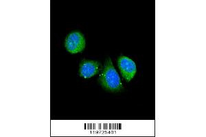Image no. 1 for anti-Asporin (ASPN) (AA 242-269) antibody (ABIN390536)