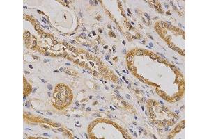 Immunohistochemistry of paraffin-embedded Human kidney using ARHGAP25 Polyclonal Antibody at dilution of 1:200 (40x lens).