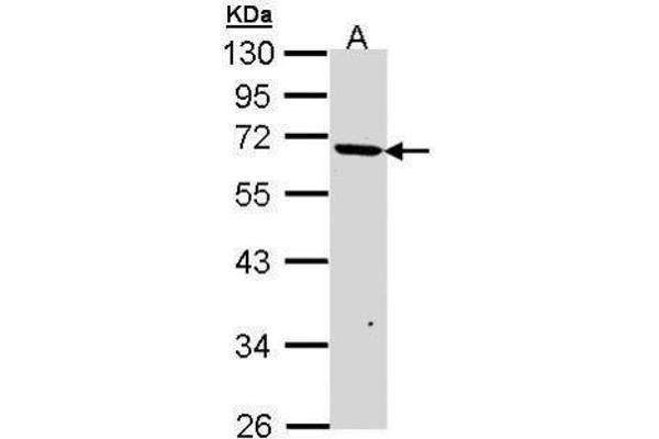 JMJD6 antibody  (Center)