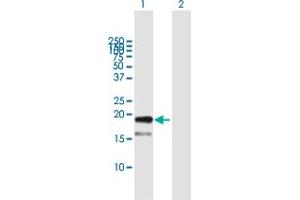 Image no. 1 for anti-Teratocarcinoma-Derived Growth Factor 1 (TDGF1) (AA 1-188) antibody (ABIN948535)