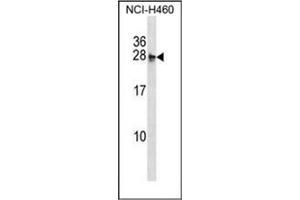 Image no. 1 for anti-Molybdenum Cofactor Synthesis 2 (MOCS2) (AA 13-43), (N-Term) antibody (ABIN953476)