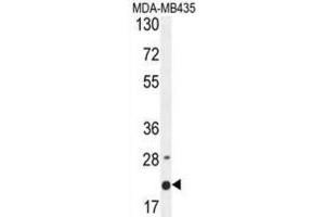 Image no. 2 for anti-Membrane-Spanning 4-Domains, Subfamily A, Member 4 (MS4A4A) antibody (ABIN2995855)