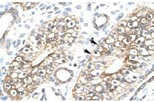 Image no. 2 for anti-MYST/Esa1-Associated Factor 6 (MEAF6) (N-Term) antibody (ABIN5648970)