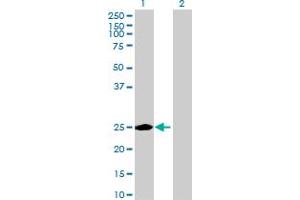 Image no. 1 for anti-MAU2 Sister Chromatid Cohesion Factor (MAU2) (AA 1-218) antibody (ABIN525126)