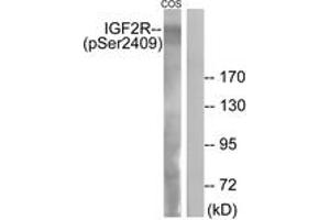 Western blot analysis of extracts from COS7 cells treated with UV 15', using IGF2R (Phospho-Ser2409) Antibody.