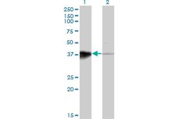 anti-Homeobox B5 (HOXB5) (AA 170-267) antibody