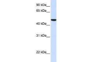 Image no. 1 for anti-Solute Carrier Family 2 (Facilitated Glucose Transporter), Member 6 (SLC2A6) (N-Term) antibody (ABIN2781652)