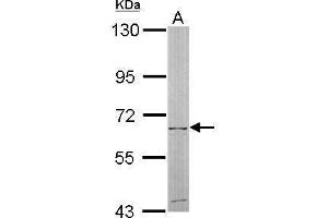 Image no. 3 for anti-5'-Nucleotidase, Cytosolic II (NT5C2) (Internal Region) antibody (ABIN2856169)
