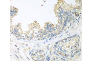 Immunohistochemistry of paraffin-embedded Human prostate using CUL3 Polyclonal Antibody at dilution of 1:100 (40x lens).