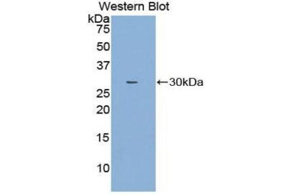 anti-Nitric Oxide Synthase Interacting Protein (NOSIP) (AA 62-295) antibody