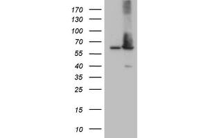 Image no. 3 for anti-Achalasia, Adrenocortical Insufficiency, Alacrimia (AAAS) (AA 322-546) antibody (ABIN2715861)