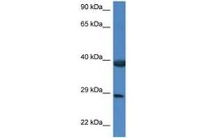 Image no. 1 for anti-HSPA Binding Protein, Cytoplasmic Cochaperone 1 (HSPBP1) (AA 226-275) antibody (ABIN6747386)