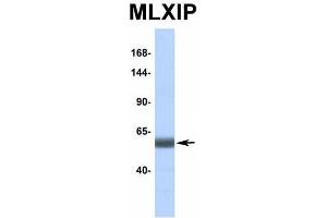 Image no. 7 for anti-MLX Interacting Protein (MLXIP) (Middle Region) antibody (ABIN2776519)