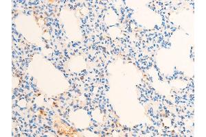 Image no. 2 for anti-Jun Proto-Oncogene (JUN) (pThr93) antibody (ABIN6255754)