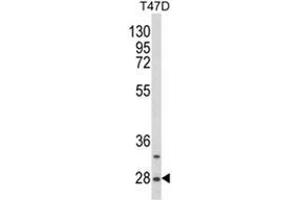 Image no. 1 for anti-Small Nuclear Ribonucleoprotein Polypeptides B and B1 (SNRPB) (AA 42-72), (N-Term) antibody (ABIN453834)