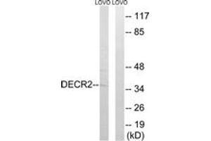 Image no. 1 for anti-2,4-Dienoyl CoA Reductase 2, Peroxisomal (DECR2) (AA 217-266) antibody (ABIN1535145)
