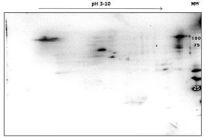 Image no. 3 for anti-Poly (ADP-Ribose) Polymerase 1 (PARP1) (C-Term) antibody (ABIN5596914)