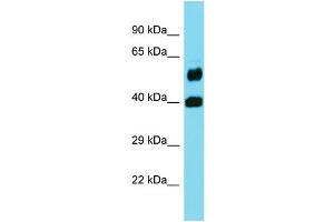 Image no. 1 for anti-Folate Hydrolase 1B (FOLH1B) (Middle Region) antibody (ABIN2791549)