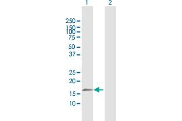 anti-Tumor Necrosis Factor, alpha-Induced Protein 8-Like 2 (TNFAIP8L2) (AA 1-184) antibody