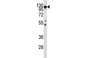 Image no. 1 for anti-Colony Stimulating Factor 1 Receptor (CSF1R) (AA 895-923) antibody (ABIN3028575)