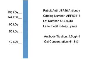 Image no. 1 for anti-Ubiquitin Specific Peptidase 26 (USP26) (Middle Region) antibody (ABIN2788023)