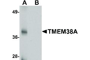 Image no. 1 for anti-Transmembrane Protein 38A (TMEM38A) (C-Term) antibody (ABIN6656409)